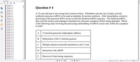 are uworld questions similar to usmle